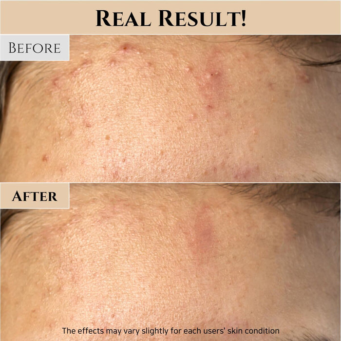 V2HA8085F716AF828FB8CA9EE517E7F0B55R7528333P8