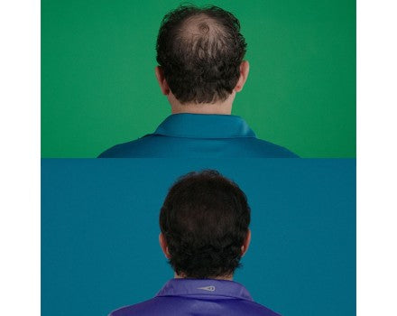 Velform Hair Grow Max 1+ 1 Grátis